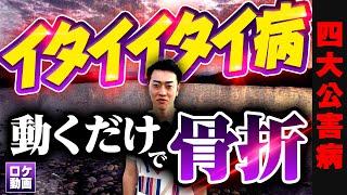 【イタイイタイ病】全身の骨が折れ身長が縮む…発生から解決までわかりやすく解説