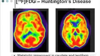 Advances in Alzheimer's Disease: Imaging and Biomarker Research