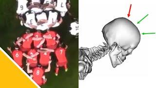 Rugby Biomechanics: Estimating Spinal Loading | Dr Dario Cazzola