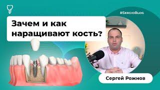 Наращивание костной ткани: как происходит подготовка к имплантации зубов? #SergioBlog