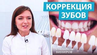 Виниры - решение эстетических проблем зубов