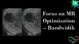 Focus on MR Optimisation - Bandwidth