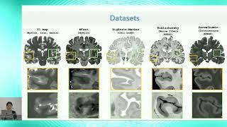 8th BigBrain Workshop 2024: Mapping superficial white matter architecture on BigBrain