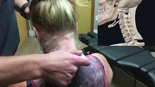 Explained neck pain treatment video | Avail Soft Tissue & Spine | Colorado