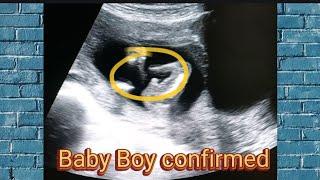 15 weeks pregnant scan baby boy ️ | 15 weeks pregnant  | 15 weeks and 5 days pregnant | gender usg