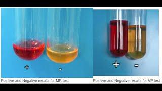 Methyl read/Vogues-Proskauer (MR/VP)