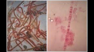 Salivary gland chromosomes Experiment | Polytene Chromosomes | Giant chromosomes