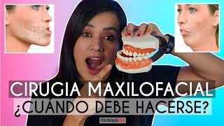 Cirugia Maxilofacial  ¿Cuándo debe hacerse?  ¿Cómo saber si la necesito?  - Odontología Láser