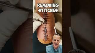 DOCTOR REACTS: REMOVING STITCHES!  #shorts #satisfying