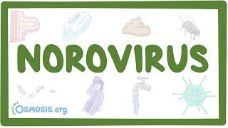 Norovirus- causes, symptoms, diagnosis, treatment, pathology