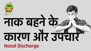 नाक बहने के कारण और उपचार | Nasal Discharge In Hindi | Healthyho