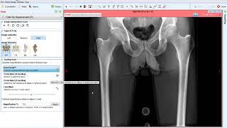 Scaling the Images | Materialise OrthoView 7.0 Tutorial