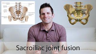 Sacroiliac joint fusion surgery
