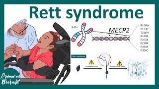 Rett Syndrome | Cellular and molecular basis of Rett syndrome | Treatment of Rett Syndrome.