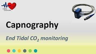 Capnography | End tidal CO2 monitoring | Little Criticos