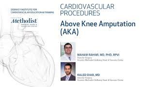 Above Knee Amputation (AKA) - (Maham Rahimi, MD & Kaled Diab, MD)