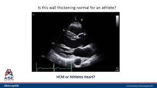 HCM versus Athlete's Heart (HCM Microlesson Case Example #2)