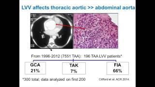 Are 14-3-3 proteins important antigens in large vessel vasculitis?