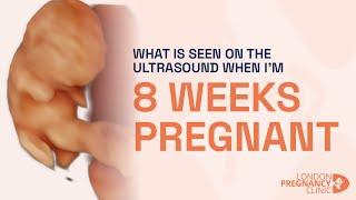 8 Weeks Pregnant: First Movements via 4D Ultrasound Scan