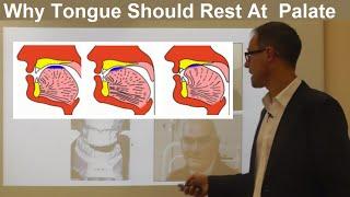 Should Tongue Rest/ Touch at the Palate/ Maxilla/ Roof of the Mouth By Dr Mike Mew