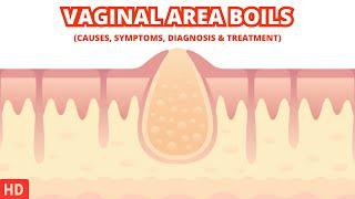 Dealing with Vaginal Area Boils: Tips and Advice for Fast Relief