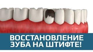 Восстановление зуба. Наращивание зуба на штифте