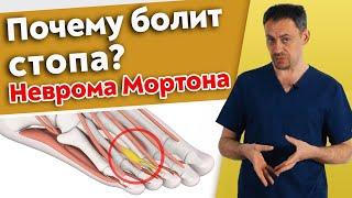 Как вылечить боль в стопе? / Что такое неврома Мортона?