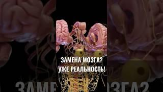 Замена мозга? Уже реальность! #нейробиология #открытия #мозг #здоровье #зож #медицина #наука