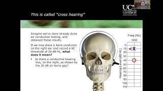 Introduction to Clinical Masking in Audiology