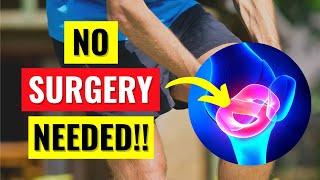 Why You Don't Need Surgery For Your Meniscus Tear