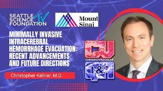 Minimally Invasive Intracerebral Hemorrhage Evacuation - Christopher Kellner, MD