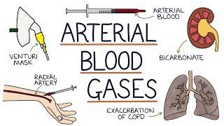 Understanding Arterial Blood Gases