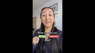 What pimples you SHOULD and SHOULDN’T pop?