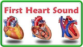 First Heart Sound (1st Heart sound) : Intensity, Wide splitting of S1 and Reverse splitting of S1