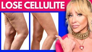 How To Get Rid Of Cellulite For Good | Science-Backed Ways