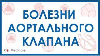 Болезни аортального клапана: аортальный стеноз, недостаточность аортального клапана.