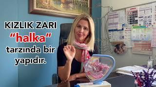 Ağda ve Jilet yapmak KIZLIK ZARINA zarar verir mi?