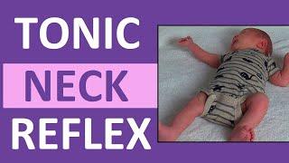 Tonic Neck Reflex in Infant Newborn | Pediatric Nursing Newborn Assessment