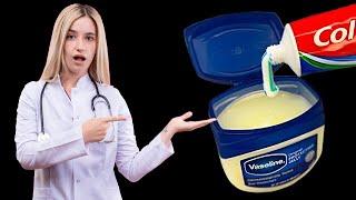 the benefit vaseline