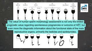 BasicMicroscopic Semen Analysis