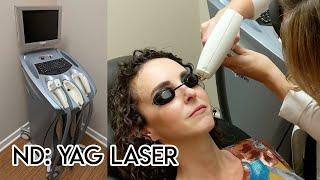 ND: Yag Laser