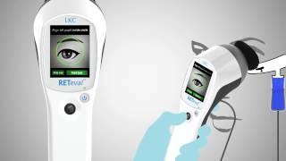 RETeval™ Visual Electrodiagnostic System