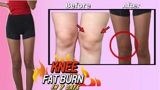 KNEE FAT BURN WORKOUT  get TONED model legs