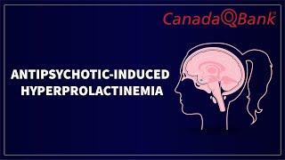 Antipsychotic-Induced Hyperprolactinemia: Causes, Symptoms & Clinical Cases | CanadaQBank