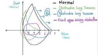 Flow Volume Loops - Respiratory Physiology - Pulmonary Medicine - Pulmonology Playlist