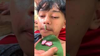 Ini akibat sering berenang di sungai lintah bisa masuk hidung #diy #kreatif #gagaheuy #viral