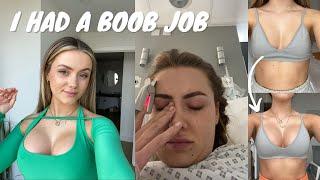 I HAD A BOOB JOB | Lets chat price, surgery, recovery and what I wish I knew