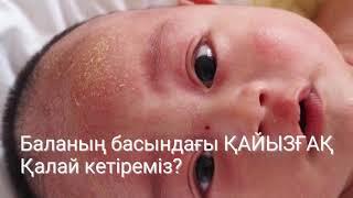 Баланың басындағы ҚАЙЫЗҒАҚ / Қалай кетіремі ? Молочные корочки новорожденного