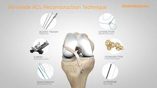 All-inside ACL Reconstruction Animation