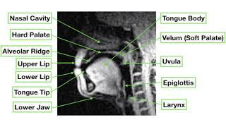 Vocal Tract MRI Shows The Complexity of Speech